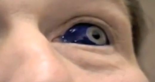 Видео о татуировках на глазах светящейся краской